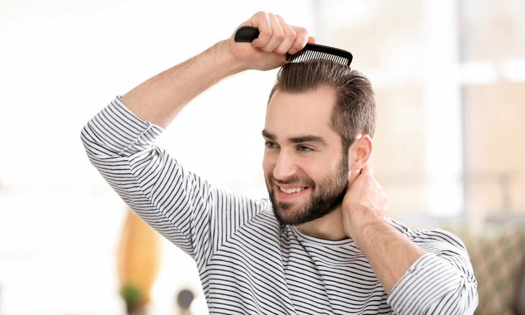 Transplante de pelo 2 hair transplant sa 4
